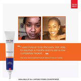 FORSCAR Gel Reparador de CICATRIZES 20ml